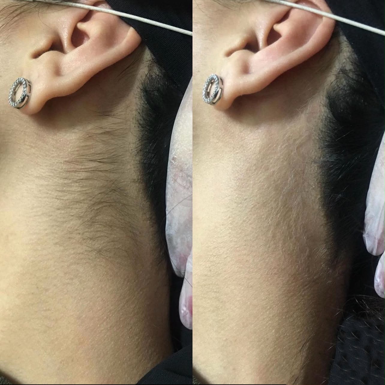 Olivérae's™ - Invisible Hair Kit