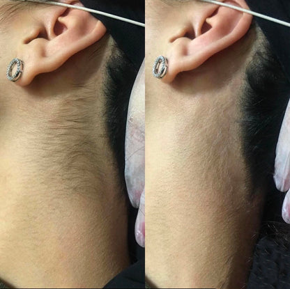Olivérae's™ - Invisible Hair Kit