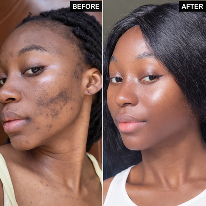 Olivérae™ - Rice Jam Mask