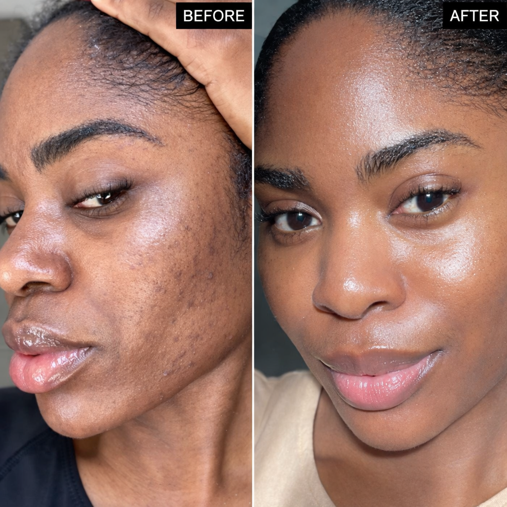 Olivérae™ - Rice Jam Mask