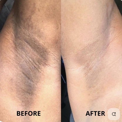 Olivérae™ - Rice Jam Mask